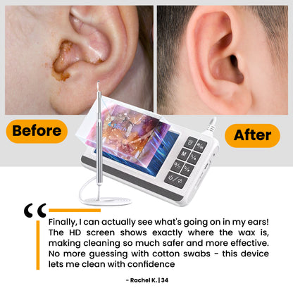 Advanced Digital Ear Cleaner